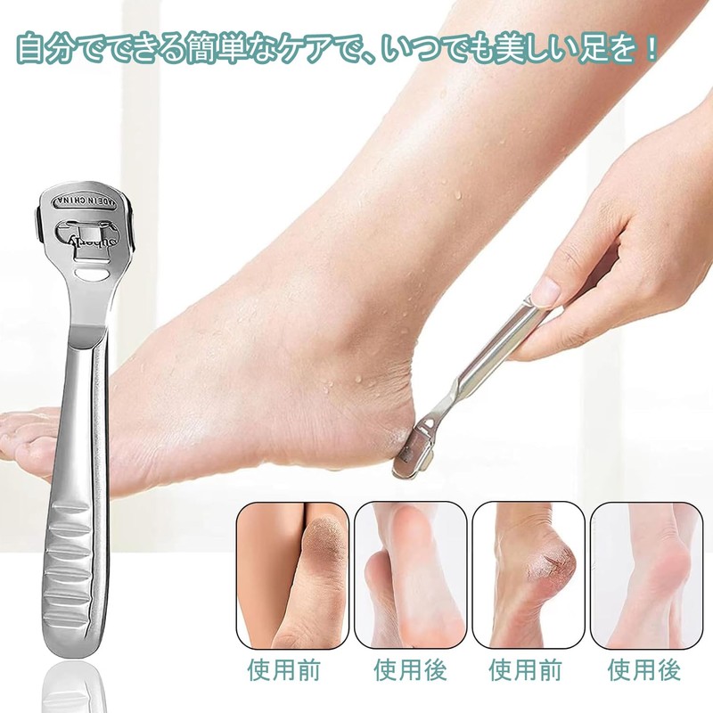 DFsucces Exfoliating Sharpener, Fish Eye Removal, Stainless Steel, Exfoliating Care,