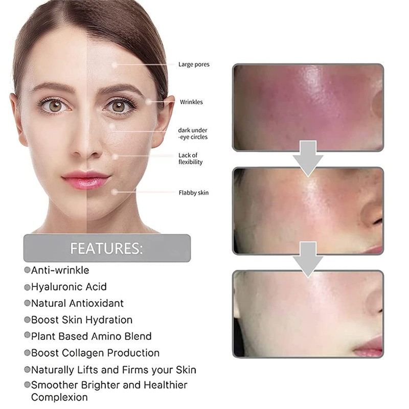 Eelhoe Eternity Vitamin C Serum Dark Spot Corrector, Esencia de