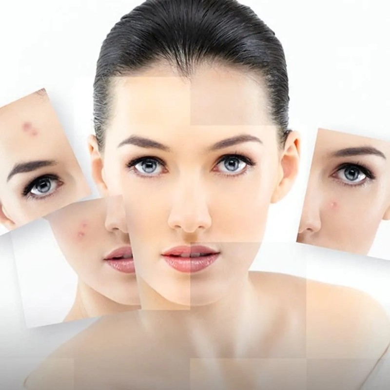 Mascarilla Pure Piel Bioaqua Acne