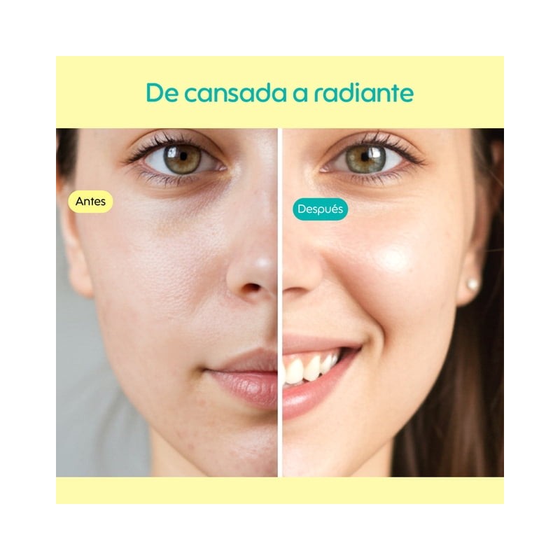 Serum kieró 30 ml