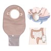 Colostomy Bag Nonwoven ABS Leak Proof Portable Ostomy Pouch for