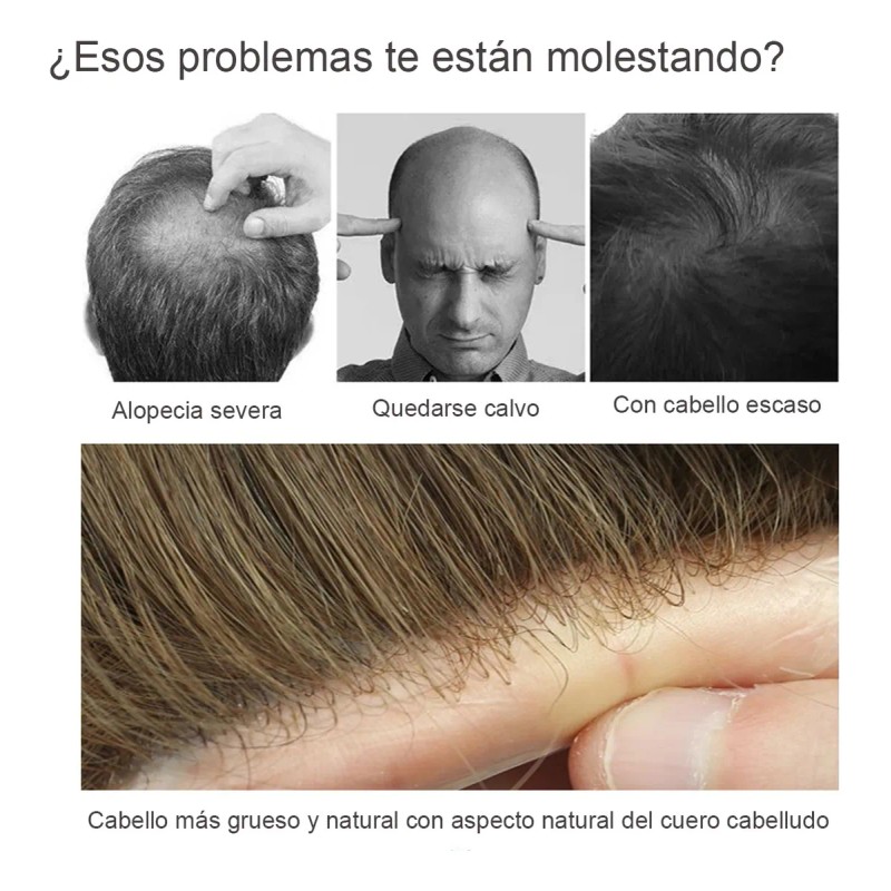 Protesis Capilar Indetectable Cabello 100% Humano
