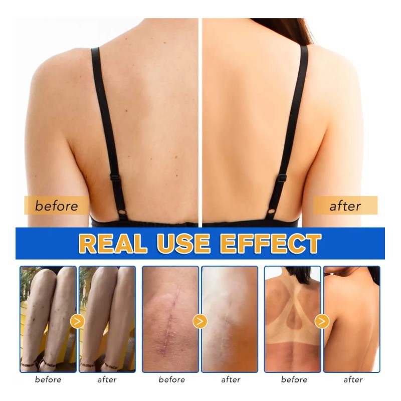 Loción Maquillaje Piernas Manchas Cicatrices Resistente Agua Brillo Mas Bello