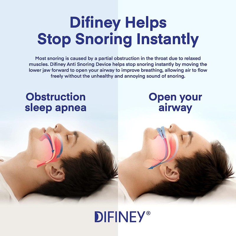 Difiney Anti Snoring Devices, Stop Snoring Devices, Effective Snoring Solution