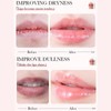 Lip Balm Set-Lip Balm Multipack, Deep Moisturizing Lip Mask Lip