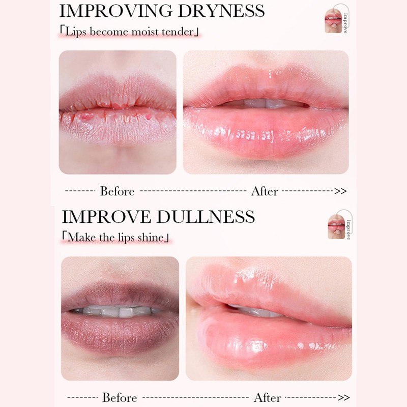 Lip Balm Set-Lip Balm Multipack, Deep Moisturizing Lip Mask Lip