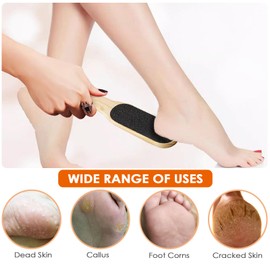 Rseuphiee Pack of 2 Callus Remover, Double-Sided Callus Rasp, Foot File, Callus Remover Foot, Coarse & Fine Callus File, for Hardened or Dry Skin to Remove Dead Skin