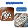 Loimon 20 Pcs Shutter Louver Repair Pins,Blind Bolt, Replacement Pins,Universal