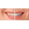 BioDenta Charcoal Whitening Toothpaste - Activated White Charcoal - 75