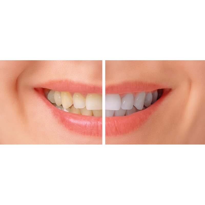 BioDenta Charcoal Whitening Toothpaste - Activated White Charcoal - 75