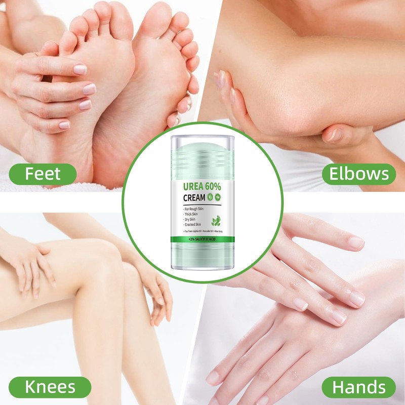 AOPEIBOTO Urea Cream 60 Percent for Feet Maximum Strength, Cracked