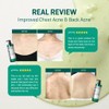 Some By Mi [SOME BY MI] BODY ACNE CLEAR AWAY