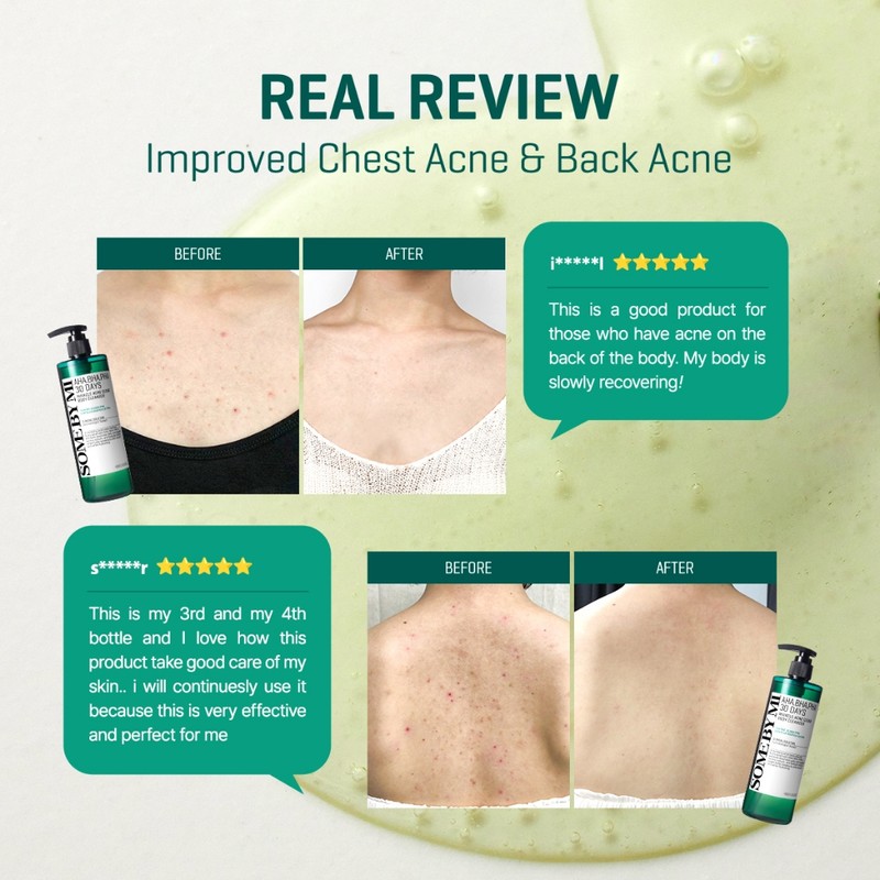 Some By Mi [SOME BY MI] BODY ACNE CLEAR AWAY