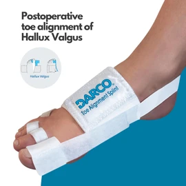 DARCO Post-Operative Toe Alignment Splint - NHS Supplied Stabilising Toe Bandage for Post-Surgery Healing - #1 Toe Support for Hallux Valgus, Tailor's Bunion & Hammer Toe Correction - One Size - White