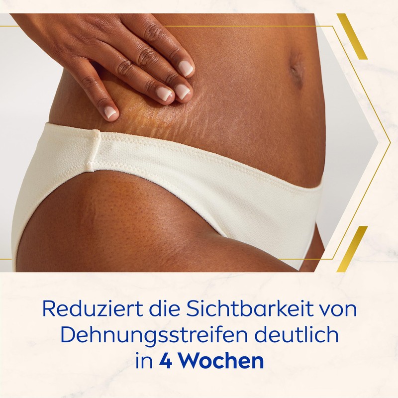 NIVEA Body Creme Anti-Dehnungsstreifen & -Pigmentflecken 200ml