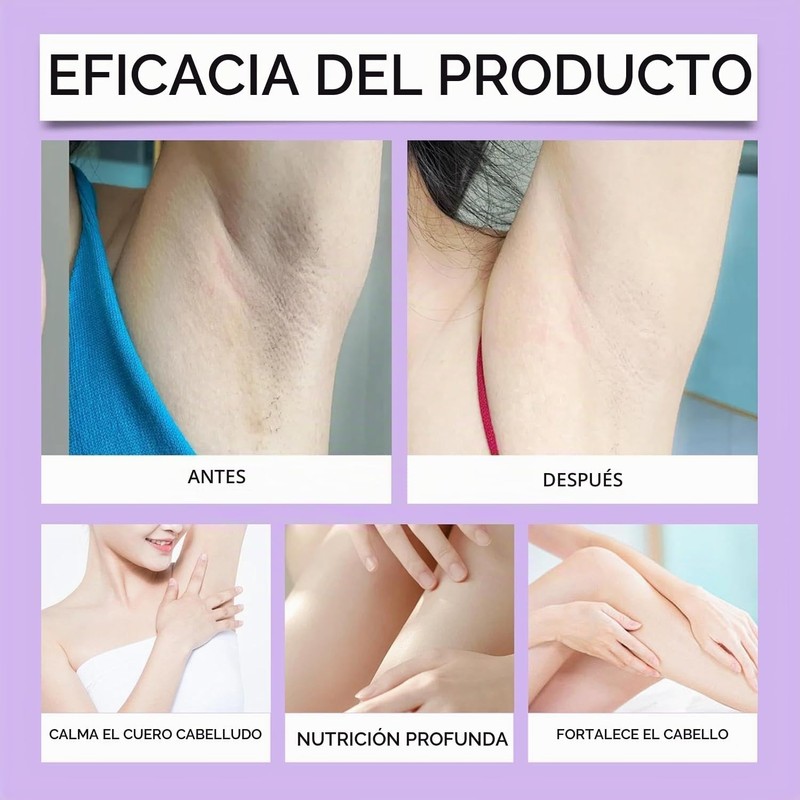Aceite Depilatorio Suero de Cyperus Rotundus – Piel Suave y