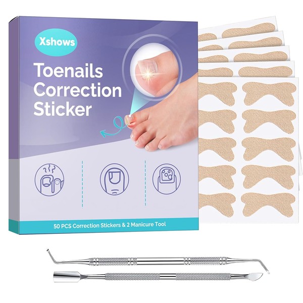 Ingrown Toenail Treatment, Breathable Ingrown Toenail Corrector Strips with File