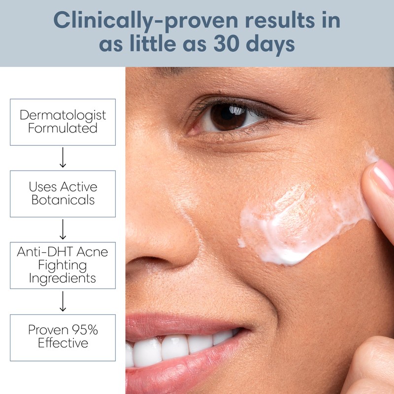 Clearogen Acne Treatment Kit, Acne Kit, Skin Care Acne, Acne