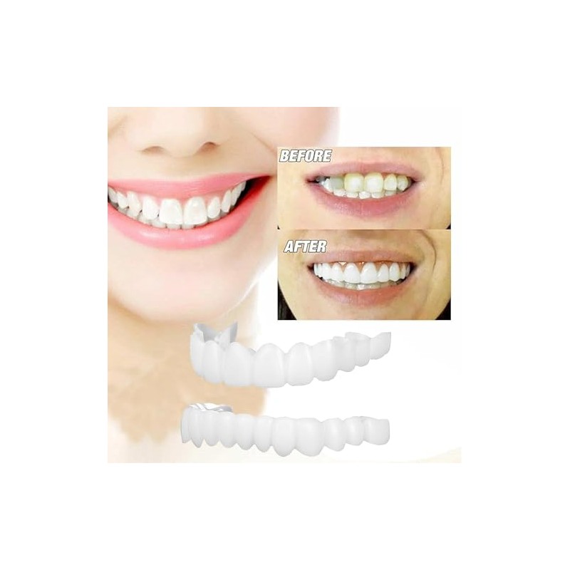 Dientes postizos blancos