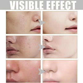 Rice Exfoliant,Black Rice Face Exfoliator,Face Scrub Exfoliator Pore Minimizer for Face,Exfoliating Face Wash,Fa/ce Serum for Women,Hydrating Serum,Fa/ce Scrub,Blackhe/ads Remover for All Skin Types