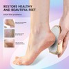 BEZOX Foot File and Callus Remover (New Upgrade) - Foot