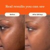 Live Tinted Superhue Hyperpigmentation Serum Stick - Barra D