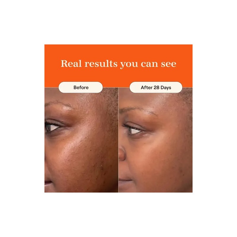 Live Tinted Superhue Hyperpigmentation Serum Stick - Barra D