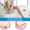Ingrown Toenails Set, Toenail Correction Patch, Nail Clip, Toenails, Ingrown