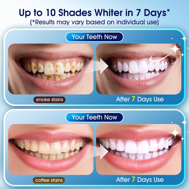 KOAEO Teeth Whitening Kit–3 Teeth Whitening Pens + 2 0123456