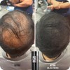 BOLDIFY Hair Fibers (Dark Blonde) Undetectable & Natural - Giant