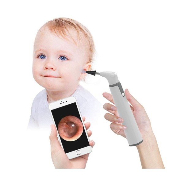 ScopeAround Wireless Otoscope, 3.9mm Ultra-Thin WiFi Ear Scope Camera with