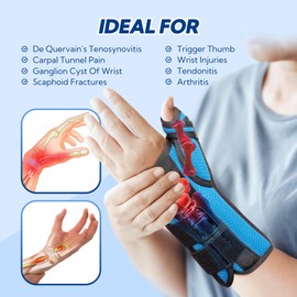 YiYame Wrist and Thumb Support, Thumb Spica Splint, De Quervain's Splint, Carpal Tunnel Wrist Splint with Thumb Support for Arthritis, Tendonitis, Trigger Thumb, Wrist Fractures, Injuries, Left-L
