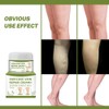 Varicose Veins Cream Natural Ointment for Varicose and Spider Veins