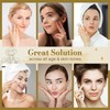 ABERA Melasma Cream (Premium Version) - Cream for Face Treatment,