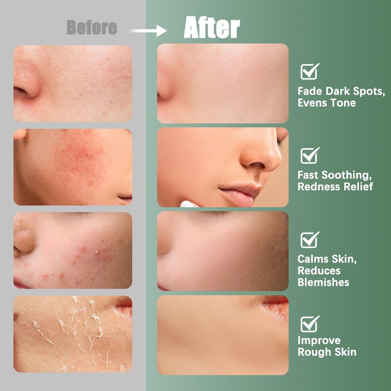 Kestper Madecassoside & Caffeine Toner Pads|Soothe Redness,Strengthen Barrier & Refine