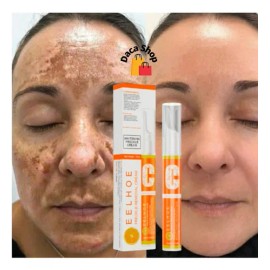Sérum blanqueador de pecas Eelhoe Melasma, 15 g, vitamina C