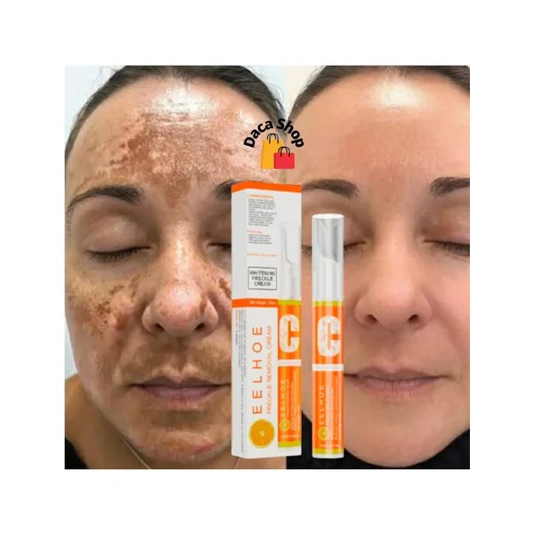Sérum blanqueador de pecas Eelhoe Melasma, 15 g, vitamina C