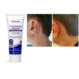 Tri Psoriasis Control Face and Body Cream 4.2 Oz, Visibly Reduce Scaly Flaky Skin
