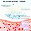 Medical Grade Hydrocolloid Roll for Wound Care