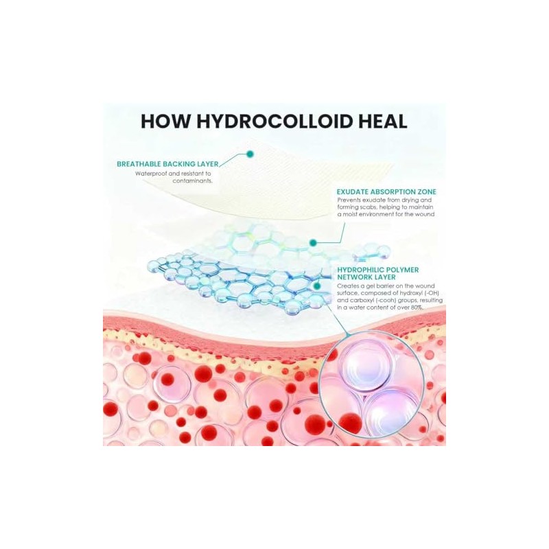 Medical Grade Hydrocolloid Roll for Wound Care