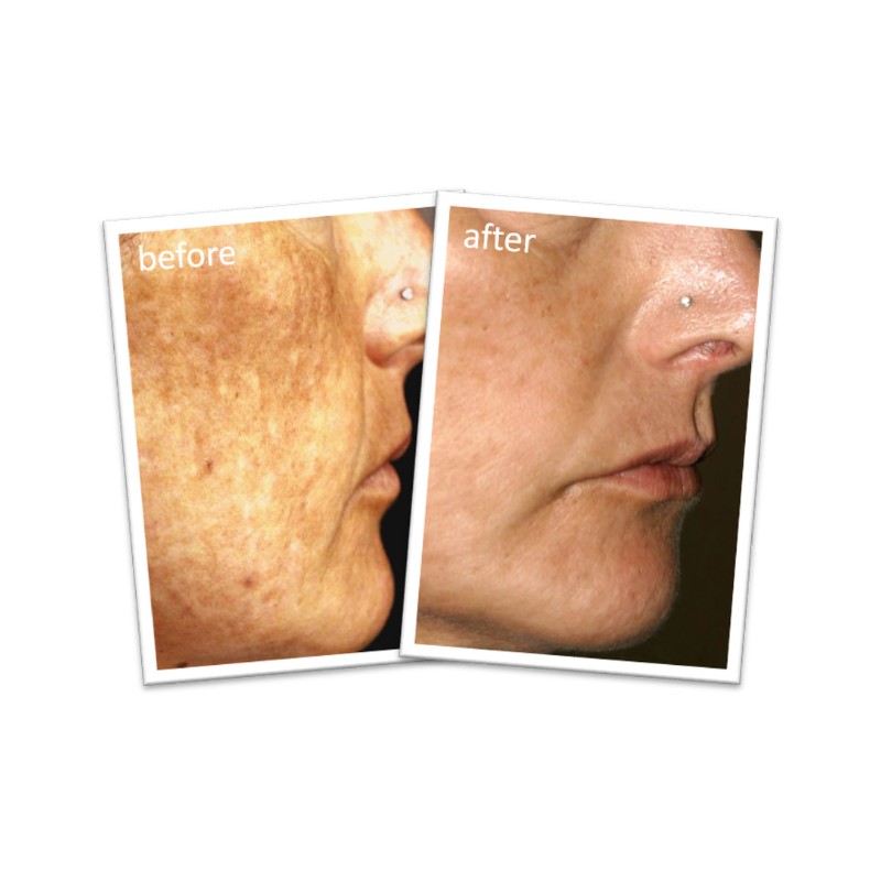 Plunkett's John Plunkett's SuperFade Original Cream 60mL (Limit ONE per