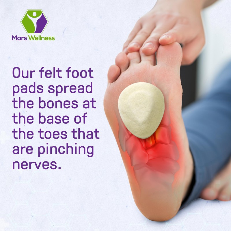 Premium Comfort Metatarsal Felt Foot Neuroma Pads - Easy to