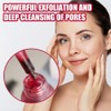Bluemega Solución Exfoliante, AHA 30% + BHA 2% Esencia de