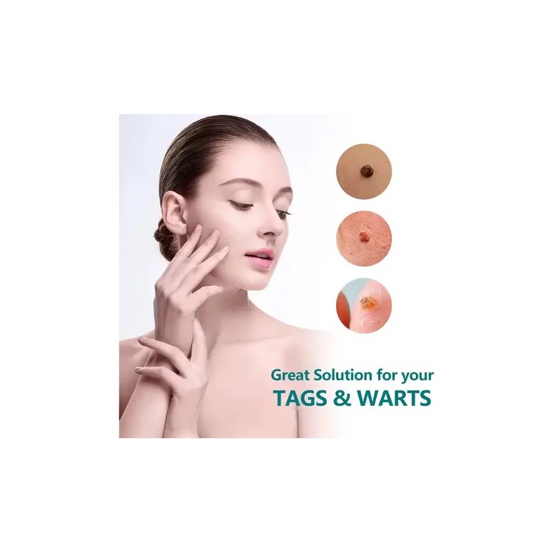 Crema Removedora Mezquinos Verrugas Lunares Eficaz Sin Dolor