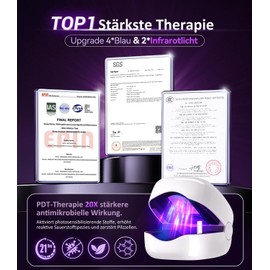 LOZLTX Medizinische Qualität Nagelpilz Laser mit Zeitmessgerät & Fruchtig Nail Care Pen【Stärkste Therapie-Schnell Wirkende】Nagelpilz Lasergerät【SGS Zugelassen-Sicher und zuverlässig】Verbesserte
