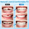 Temporary Cosmetic Tooth Kit – Moldable Tooth Beads for Missing