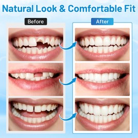 Temporary Cosmetic Tooth Kit – Moldable Tooth Beads for Missing Teeth & Denture Coverage, Natural-Looking Oral Beauty Solution, Safe Rubber Material, 30ml with 4 Accessories