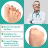 Welnove Hammer Toe Corrector and Straightener - 8 Pcs Toe