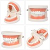 Diyiming 2Pcs Standard Teeth Model Dental Care Model, Child Brushing