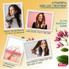 Strong Hair Conditioner Extends the Action of Milva Chinin Shampoo